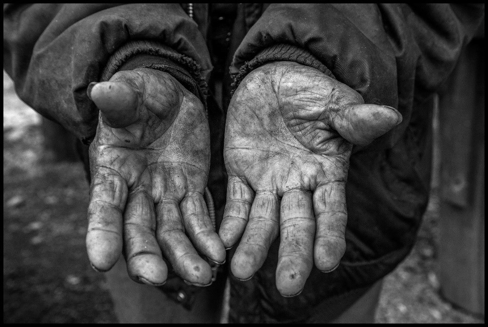 black and white photo of upturned workers hands