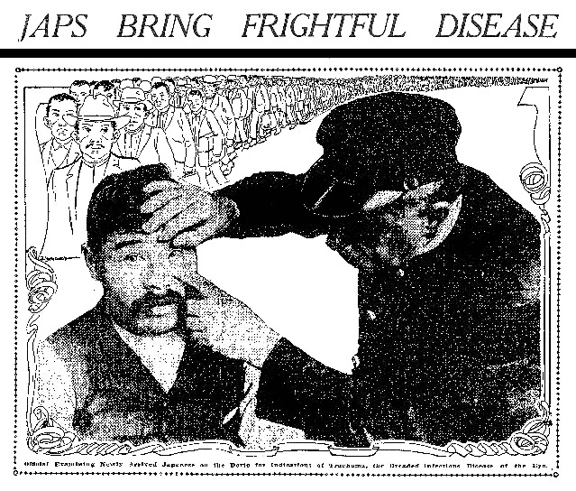 This illustration appeared in an April 1905 edition of The San Francisco Chronicle and employed a racial slur and a brand of xenophobic racism commonly seen in discussions of Japanese immigrants of the era. Courtesy of The San Francisco Chronicle via Densho.