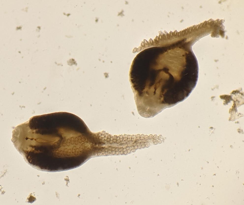 a microscope image of two parasites
