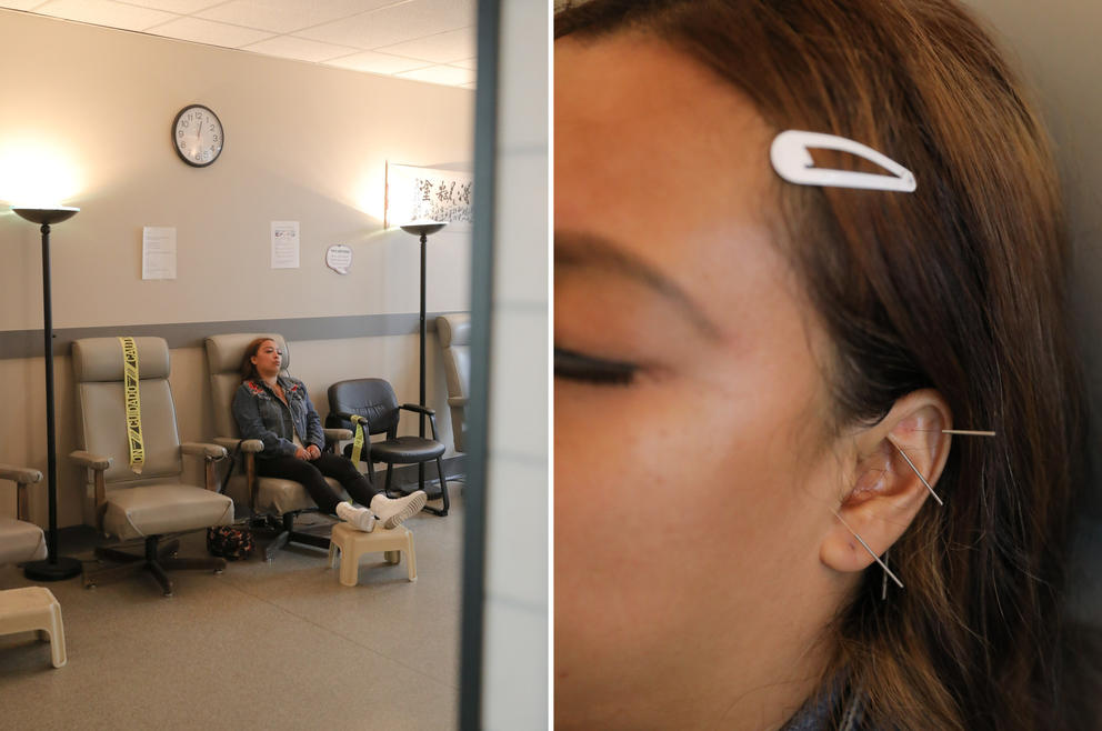 a split image. on one side, a photo of an accupuncture client sitting in a chair. on the other, a close up of her ear with needles in it