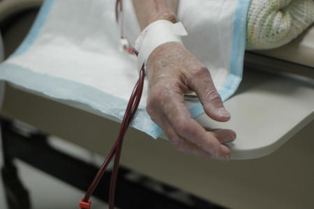 A hand with medical tubes attached to veins